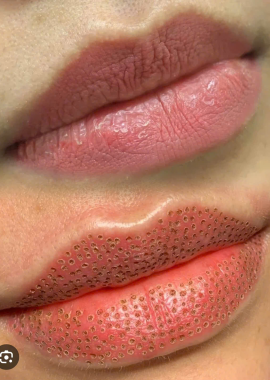 💋 Lassma Môi – Bí Quyết Sở Hữu Đôi Môi Gợi Cảm Tại SPA NGOAN ĐỖ